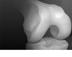 Knee Products