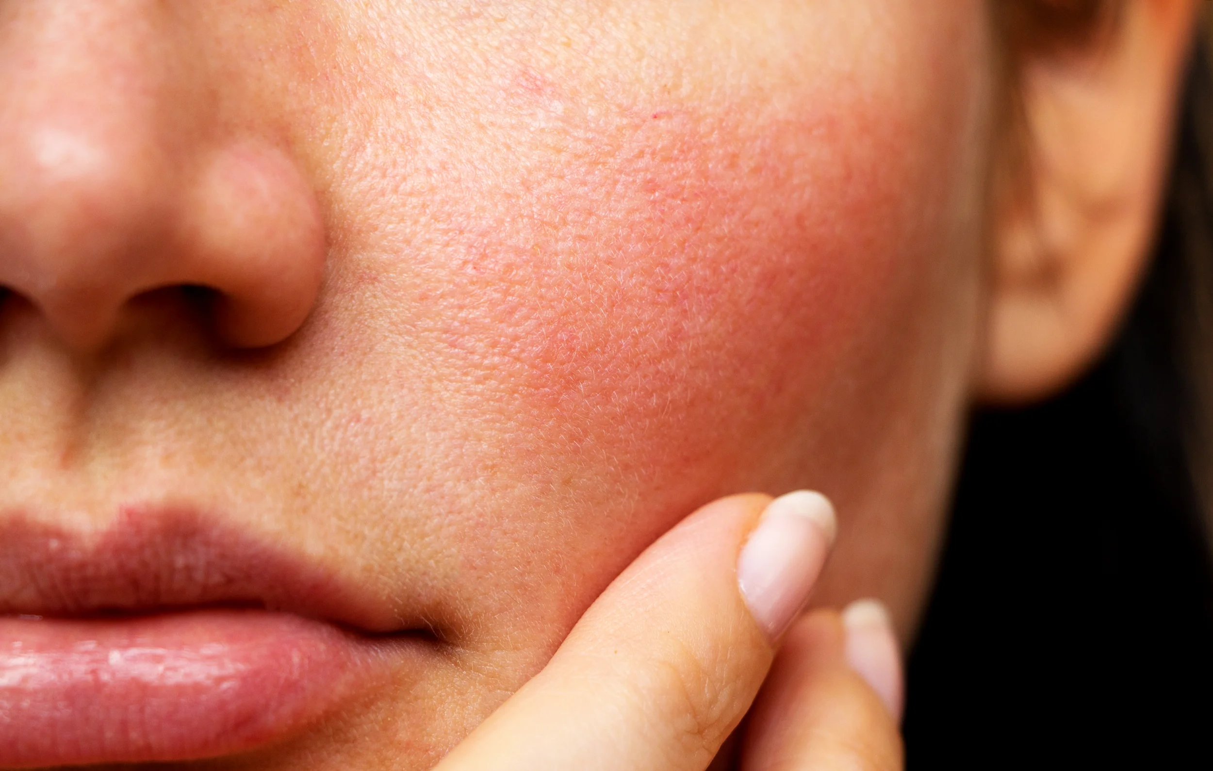 Nordora_Sensitive_Skin.jpg