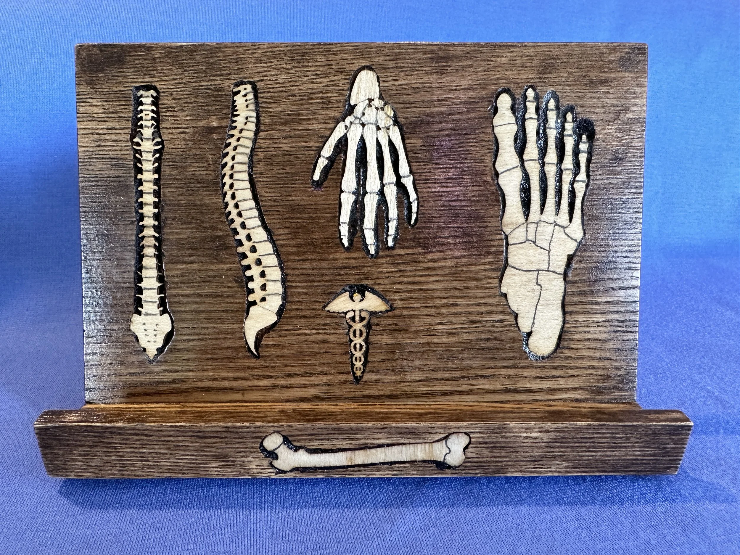 The Hidden Bones Of Perch: Discover The Secret! - a9vjw2f