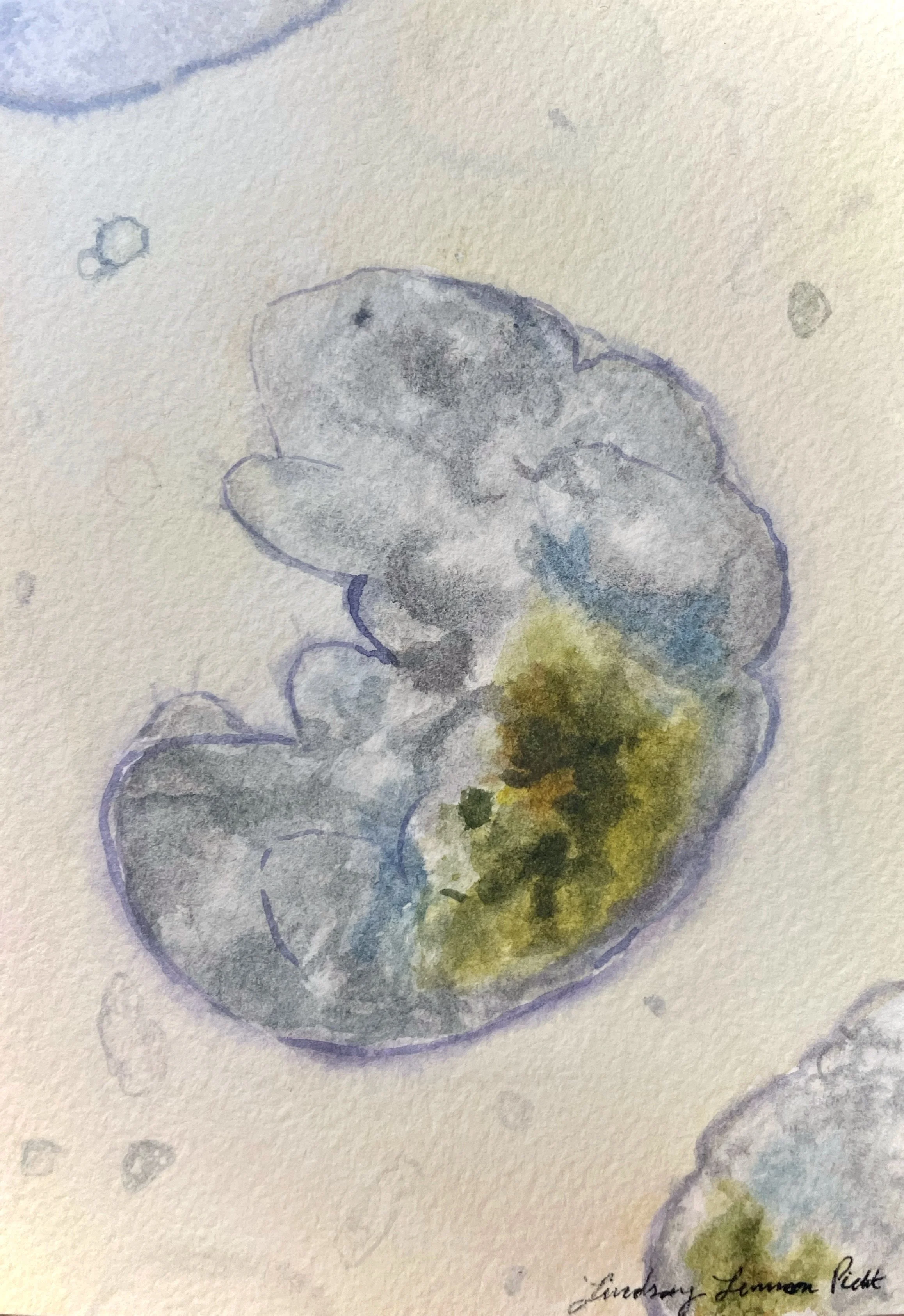 Lindsay Picht, Tardigrade.jpg