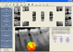 St. Joseph Mi Dentist - David Ronto - Paperless