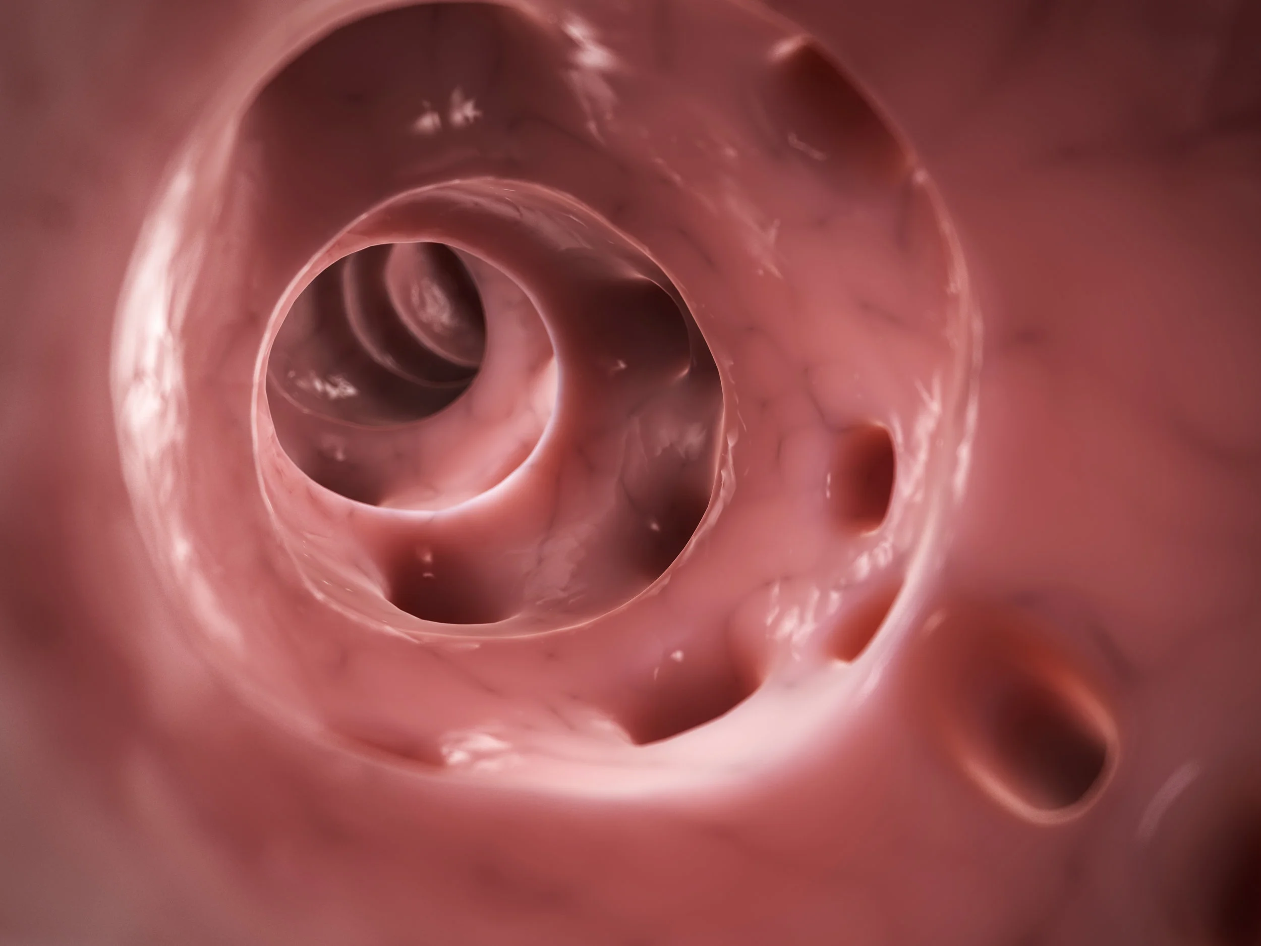 Dieta para diverticulos en el intestino