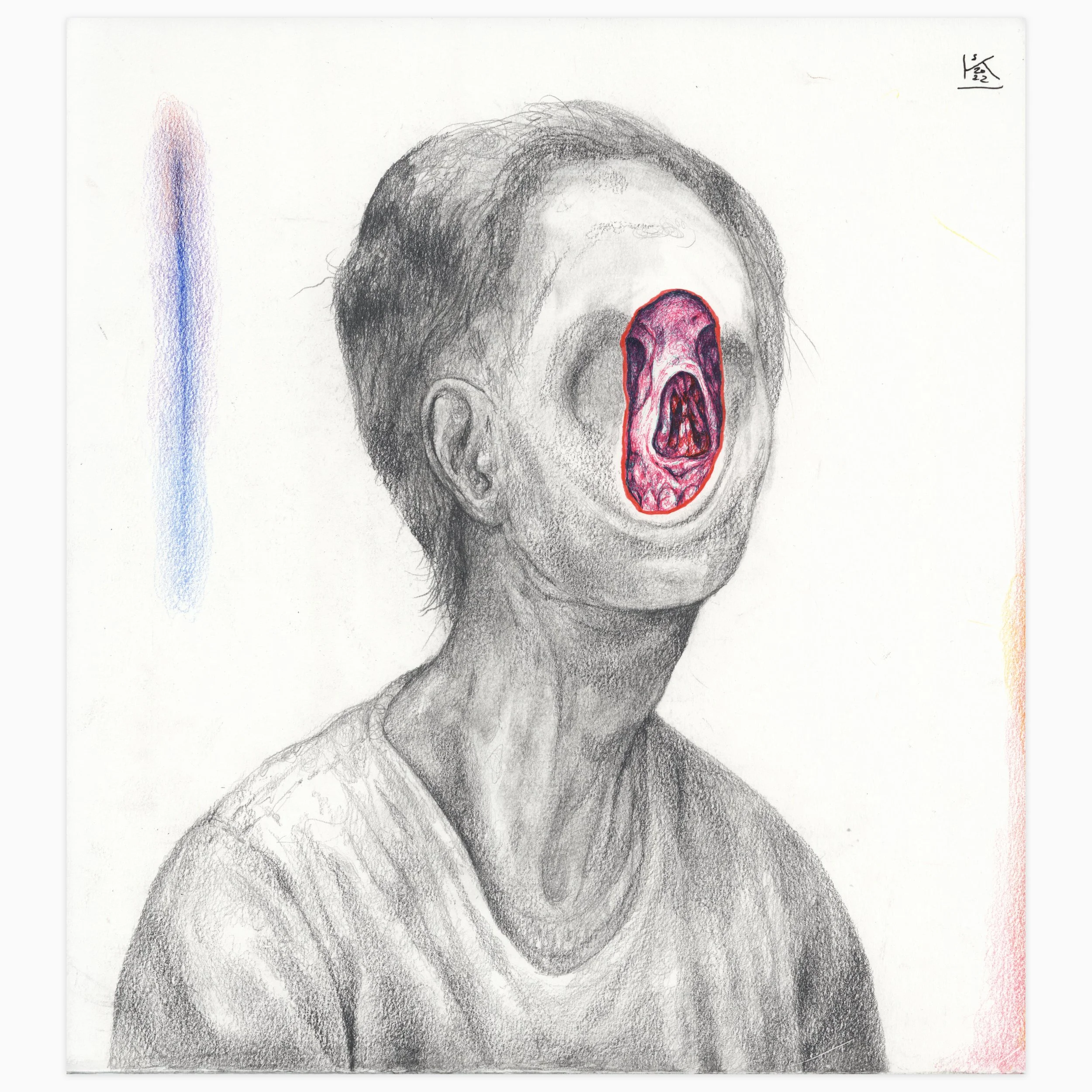 Exposure Room by Steven Ketchum