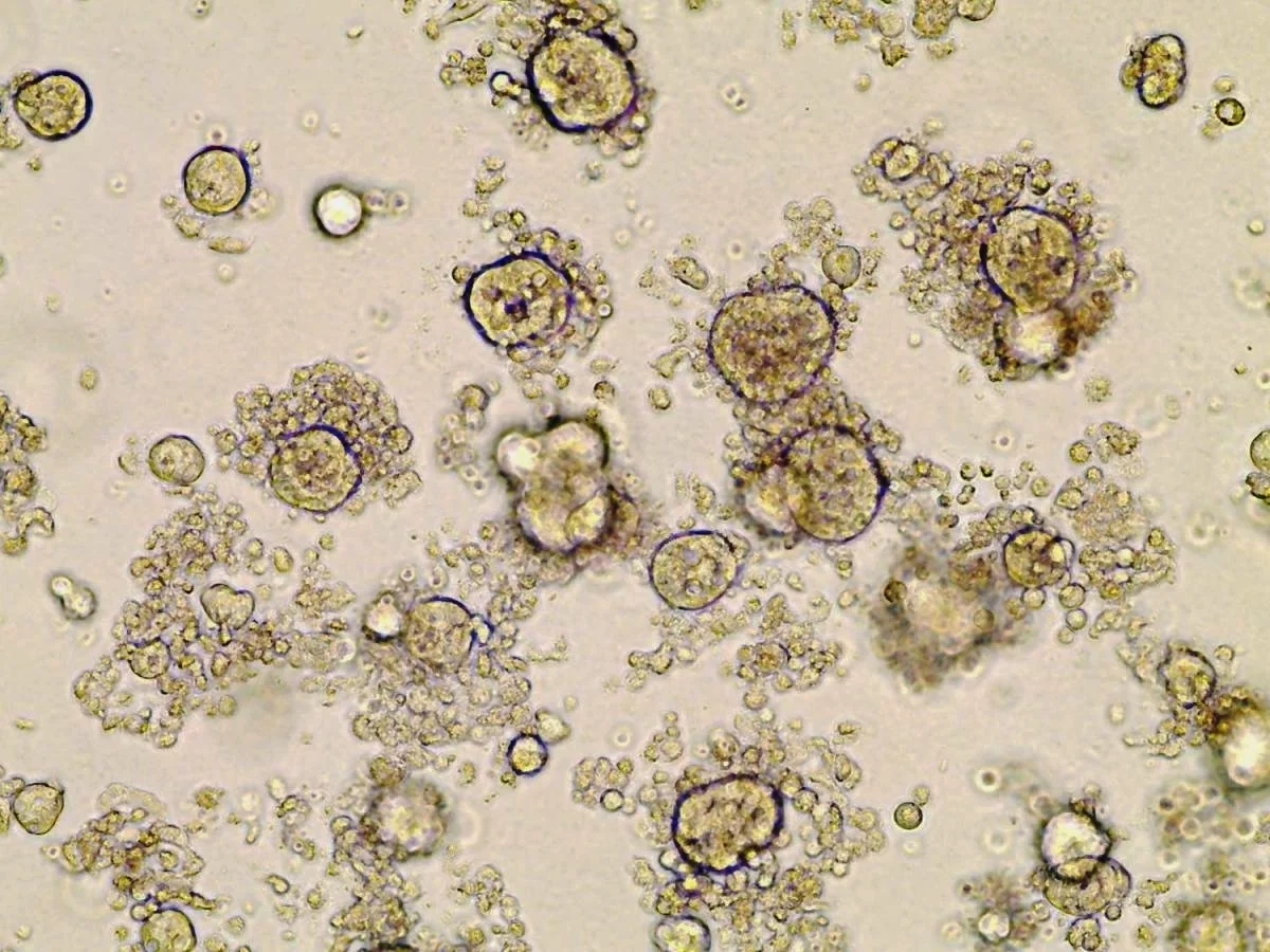 Colorectal_organoid_HF_3RsPrize.jpg