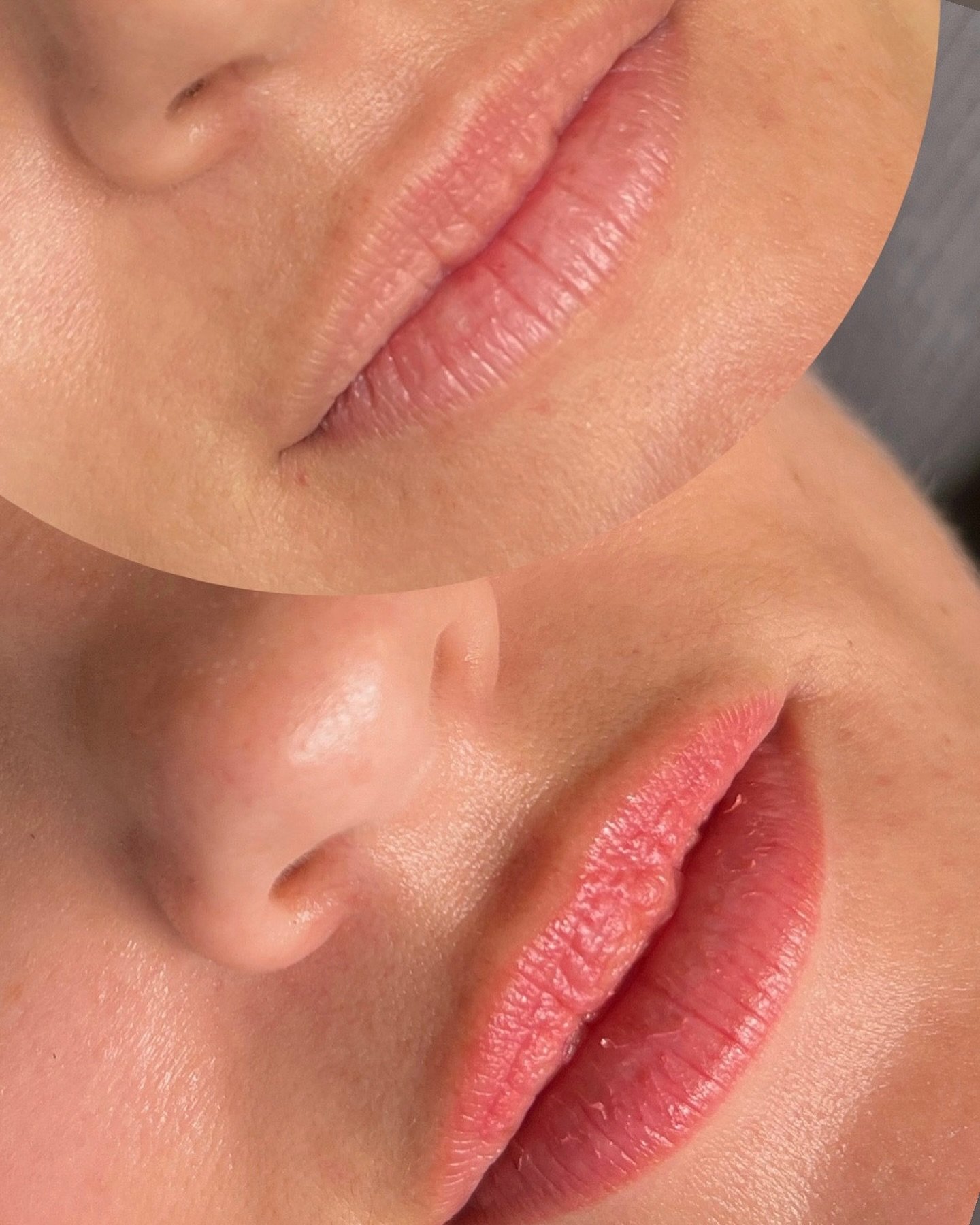 These beautiful lips are healed and have been adding a pop of color and balance to my client&rsquo;s gorgeous face for 6 months! 

Notice the HEALED results - 
- Perfect ink retention
- Even wash of color through-out entire lip
- Not blotchy
- Lip bo