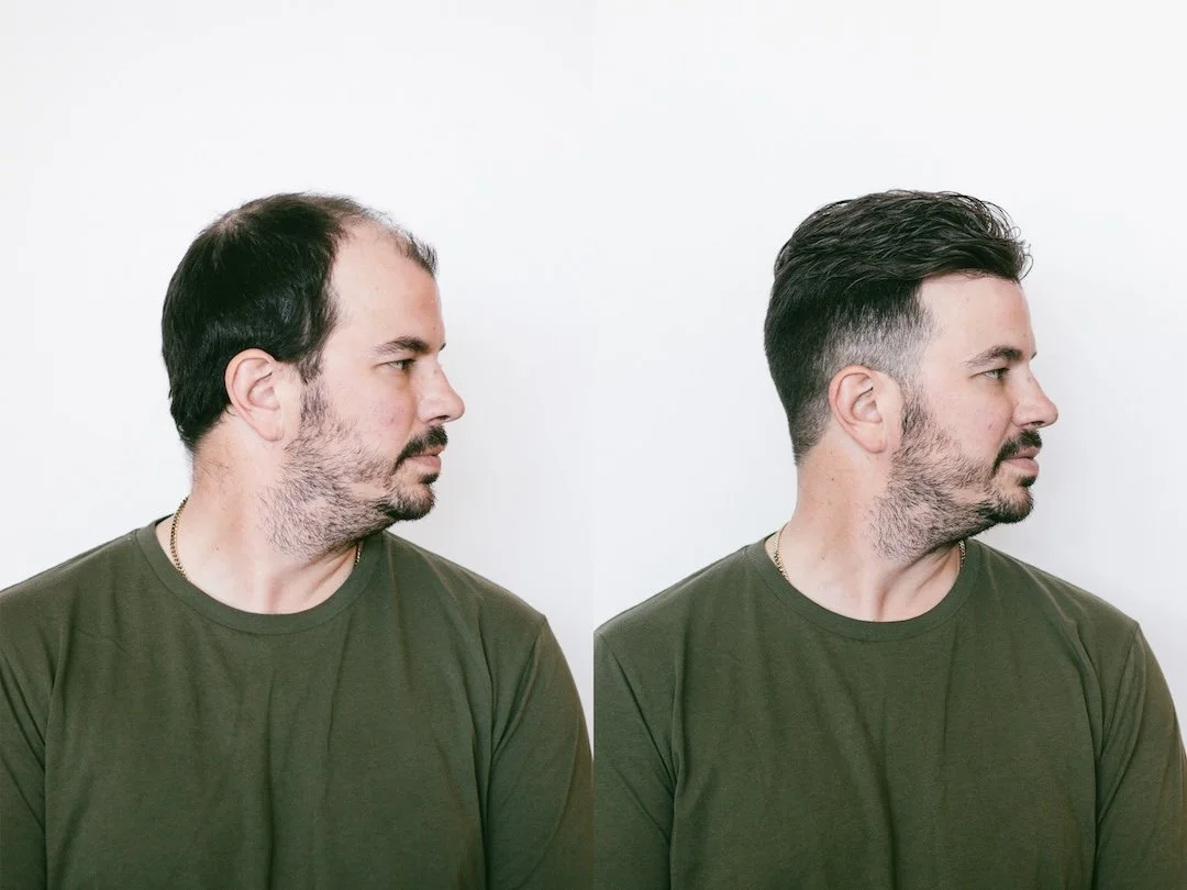 Hairskeen - Before and After 2.jpg