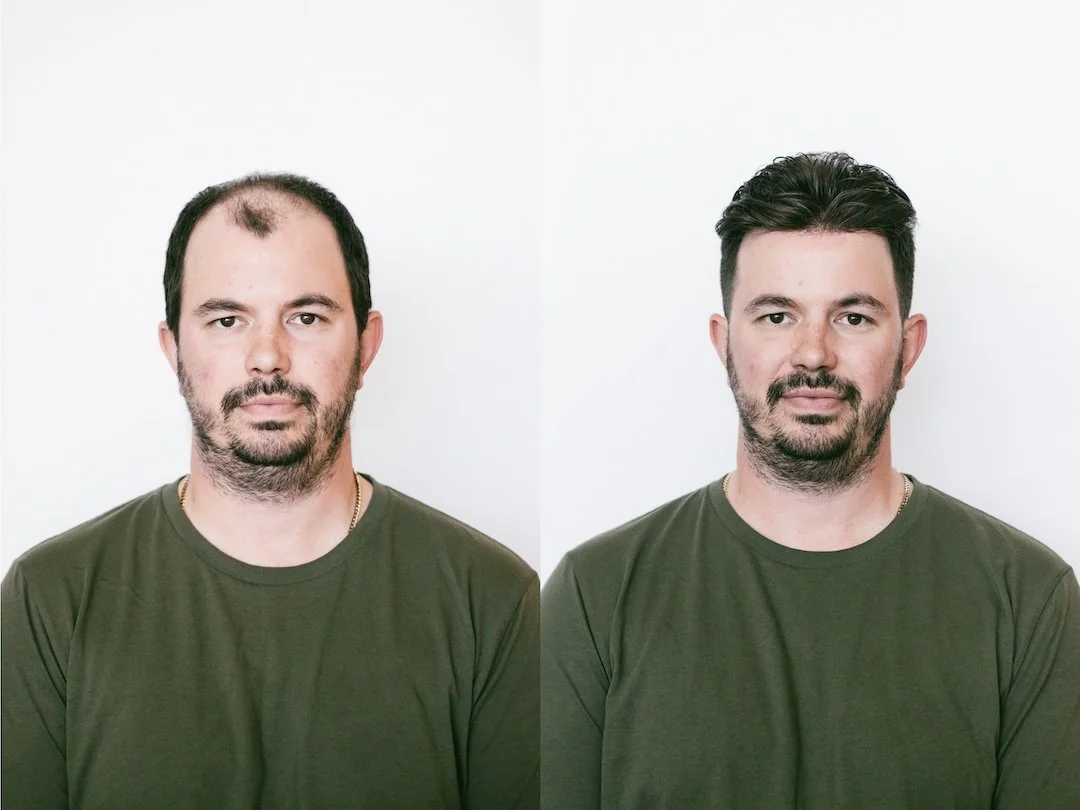 Hairskeen - Before and After 1.jpg