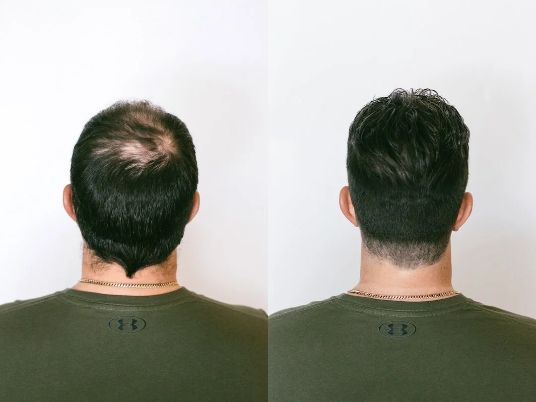 Hairskeen - Before and After 3.jpg