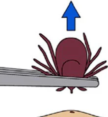 remove-b.jpg