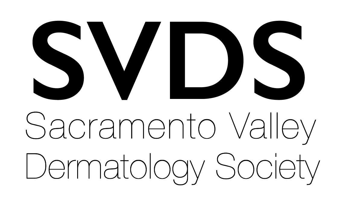 SVDS