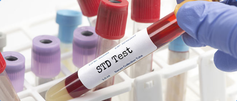 STD testing at Elon University
