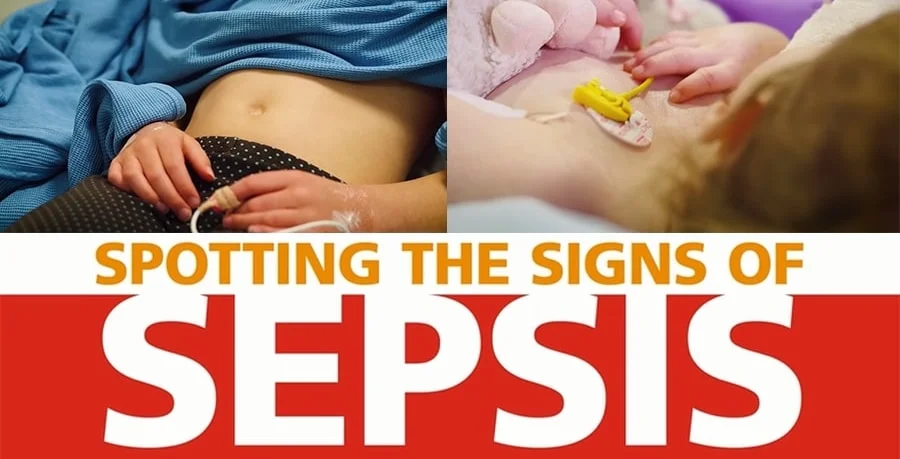 spotsepsis.jpg