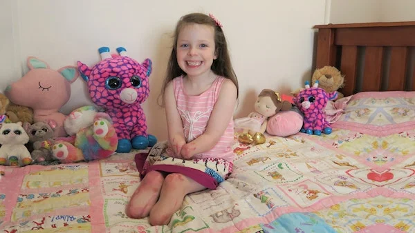 Mia – Sepsis Took Her Hands and Feet, but Not Her Spirit