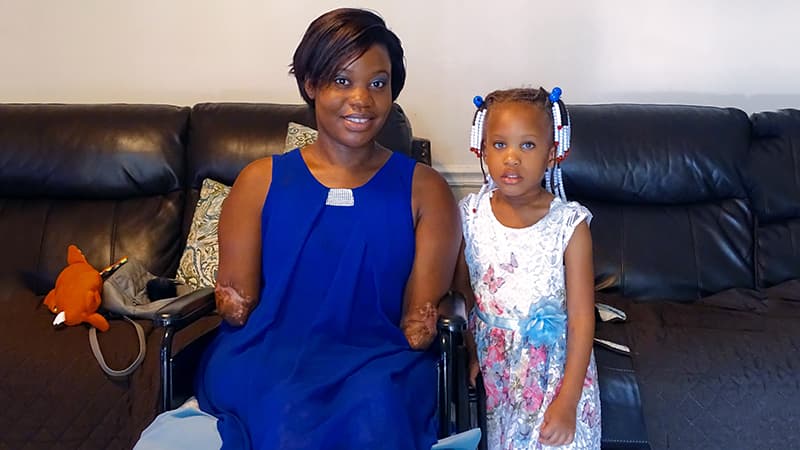 Kayleigh’s Sepsis Story - Quadruple Amputee Turning Tragedy into Triumph