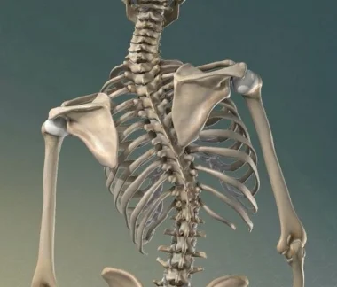 scoliosis 2.jpeg