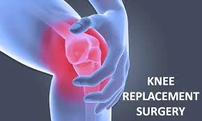 knee replace.jpg