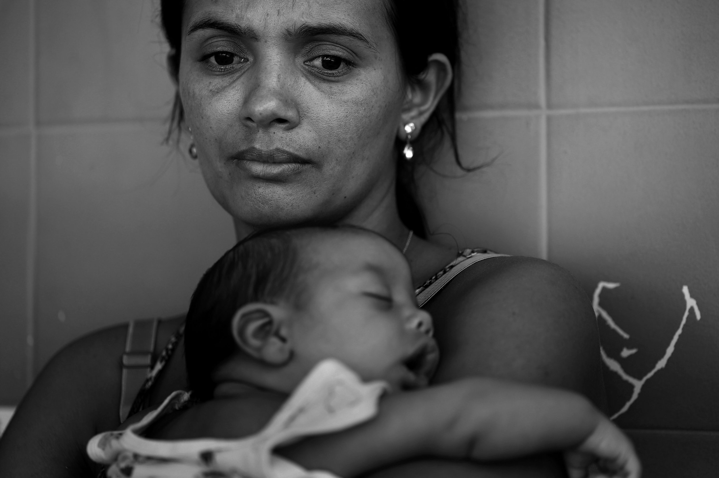  After receiving the news that her son has microcephaly, Francinelma Santos, age 29, holds Jhin Pirlo, 2 months, as she waits for a car to drive them home from the hospital. Because her son has a larger head than most babies with microcephaly, Franci
