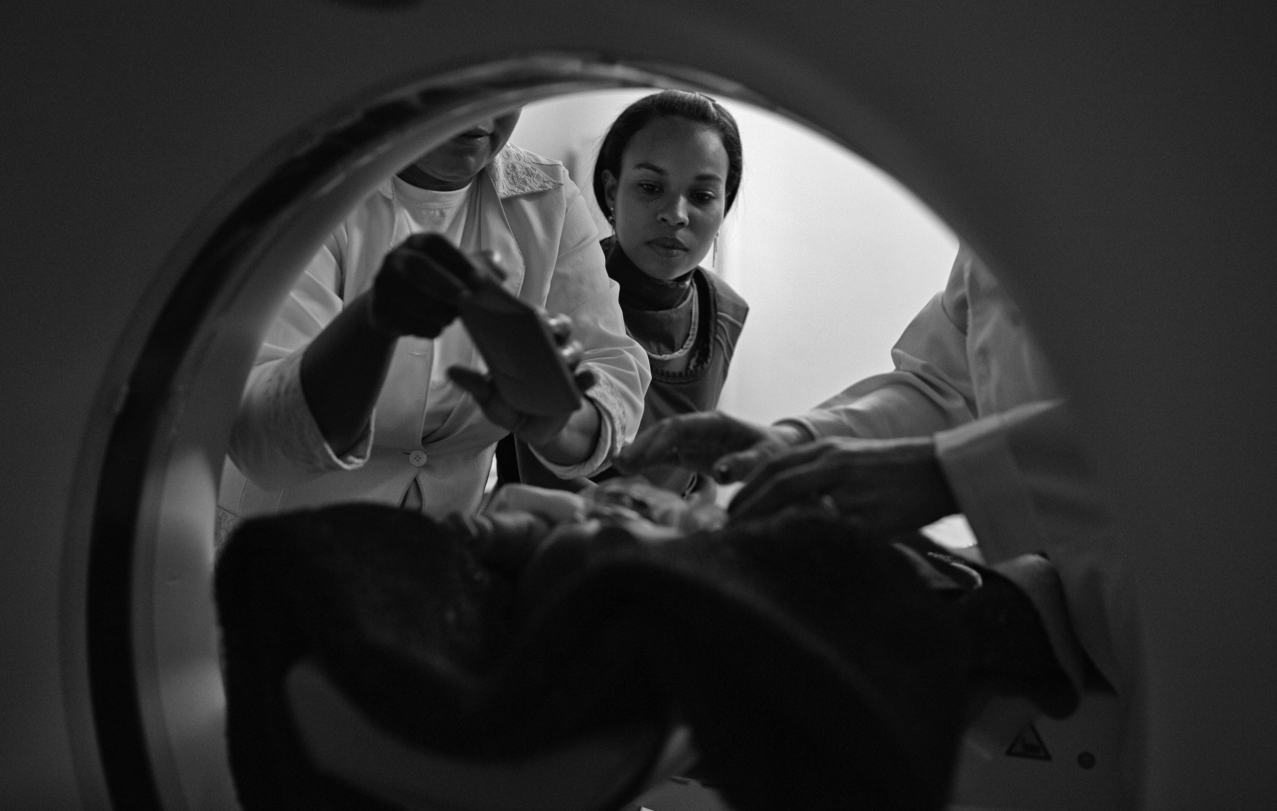  Amanda Santos, age 19, watches her baby, Emanuel, 3 months, as a nurse and radiologist technician try to calm and prepare her crying son in order to take a CT scan of his head. Emanuel was born with microcephaly, and Amanda believes she had Zika ear