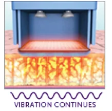 2. A specially designed treatment tip is placed against the skin in targeted areas.