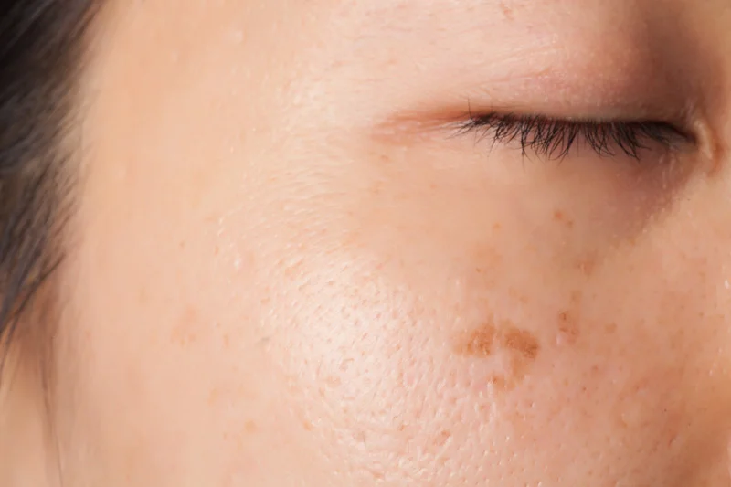 Skin_Medlite C6 Detail.jpg