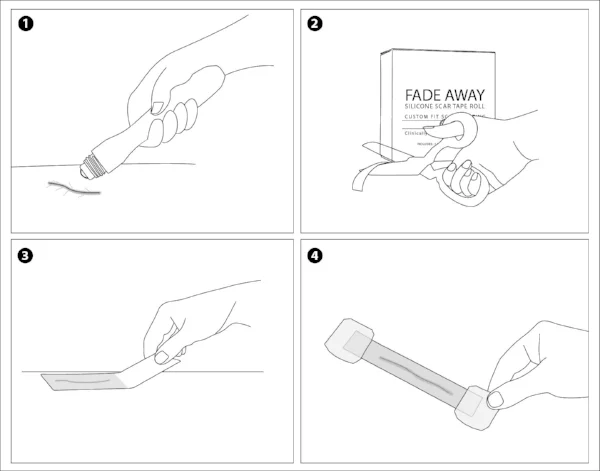 Illustrated_Scar_System.jpg