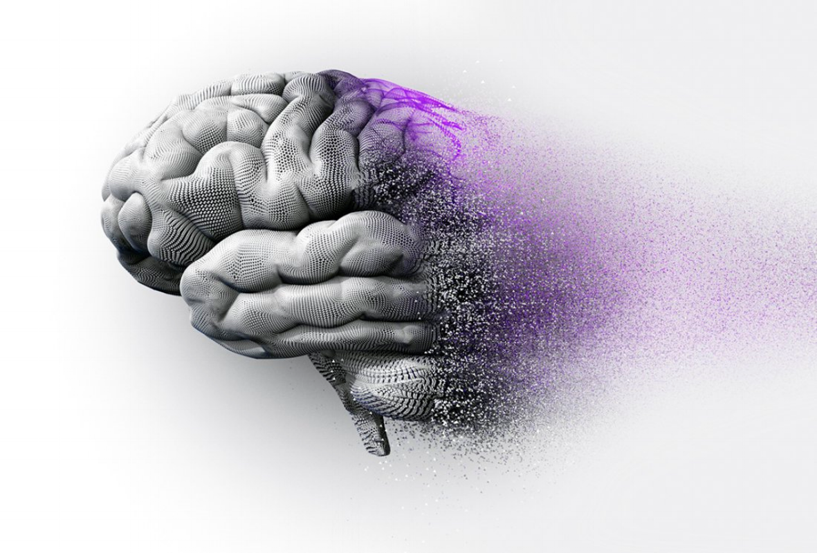 Dementia / Alzheimers 