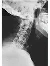 arthritis_spine_nerves_pain.jpg