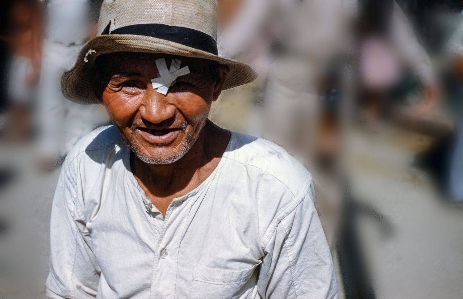 100 Man with Eye Patch