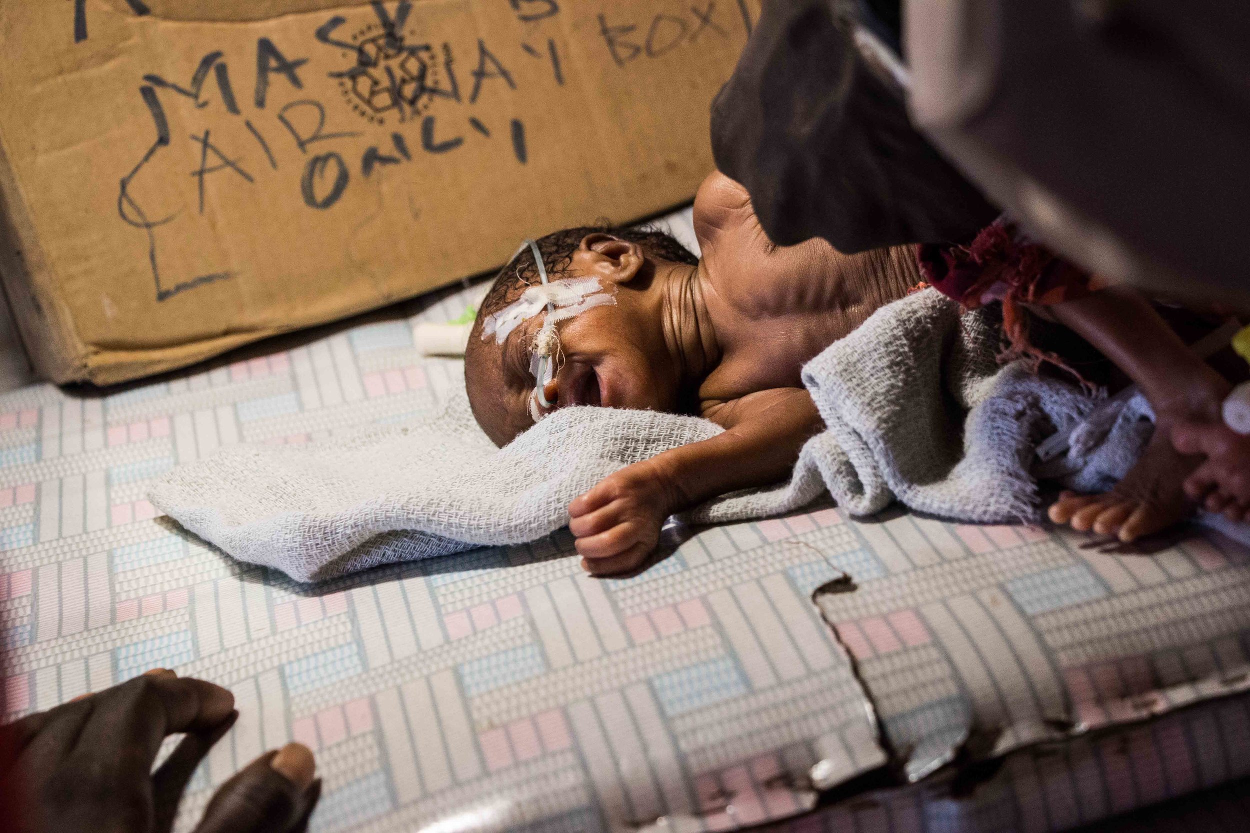 A premature baby at the MSF-supported government hospital in Aweil, South Sudan. The country has one of the highest infant and maternal mortality rates in the world. 