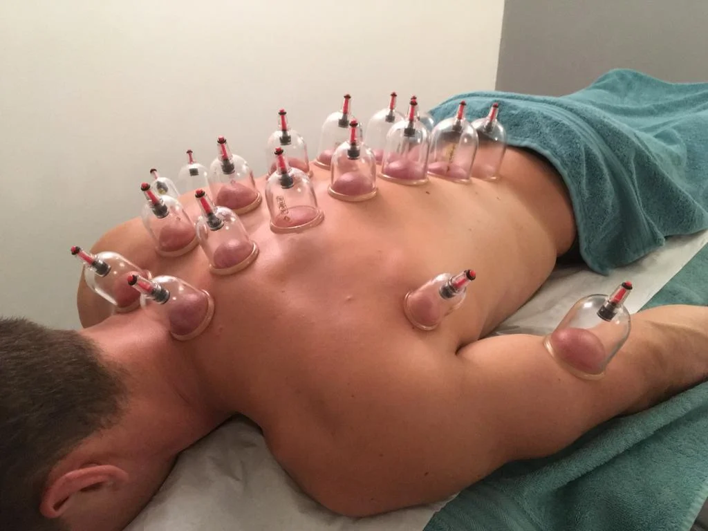 Photo Credit: Mango Acupuncture