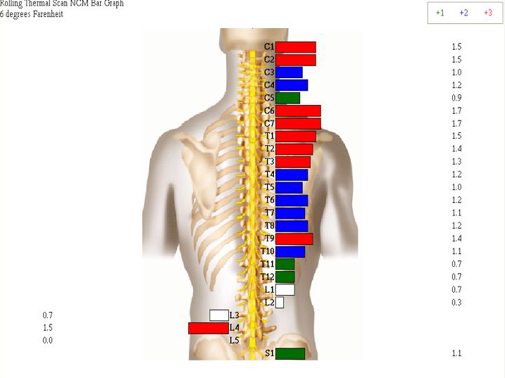 https://images.squarespace-cdn.com/content/v1/58ab350bc534a5fdedca1e4f/1488480879398-CC00JNSN2WH5ZBPLV5X0/An+initial+exam+shows+the+stress+on+the+spinal+cord