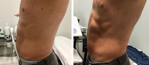 before/after (one session)