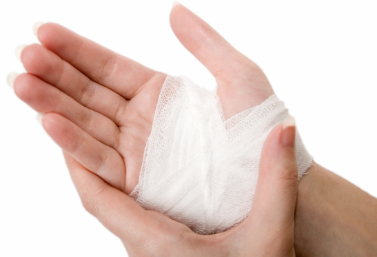 This is not an infant or small child's hand being treated for a burn. Our photo department apologizes.