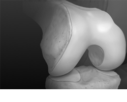 Arthrex Knee Products