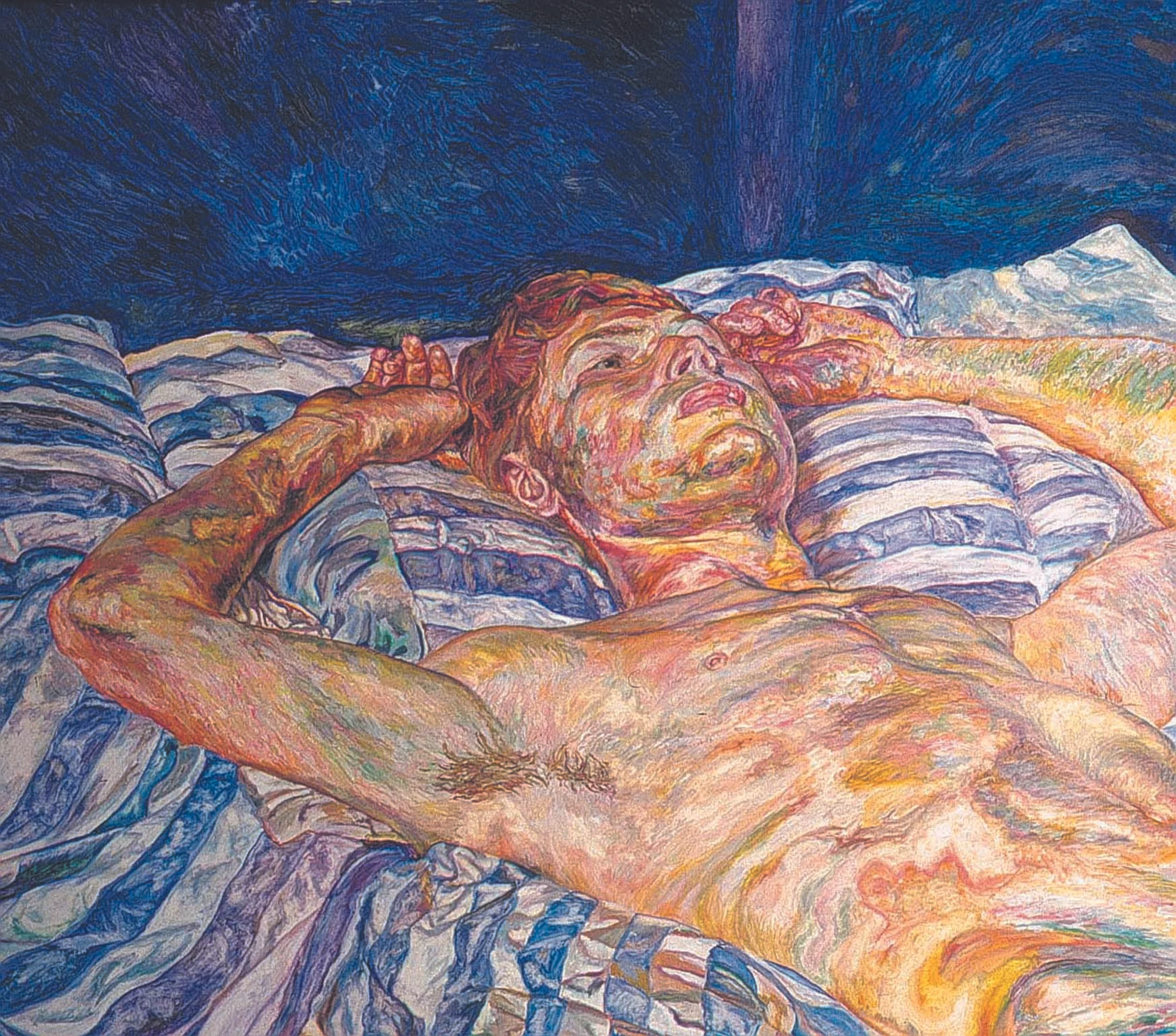 Man on a Striped Sheet