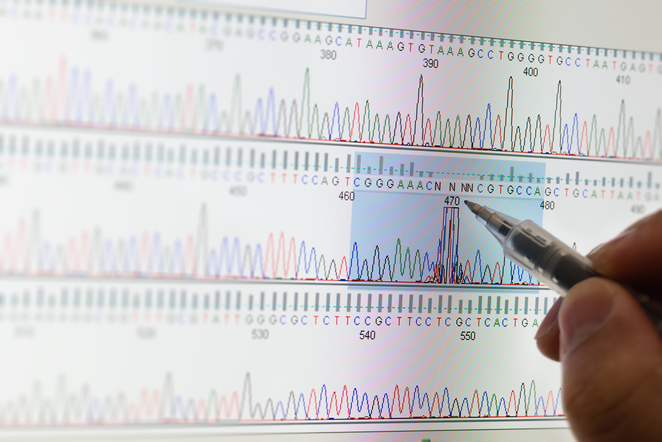 Breakthrough analysis of metabolic parameters