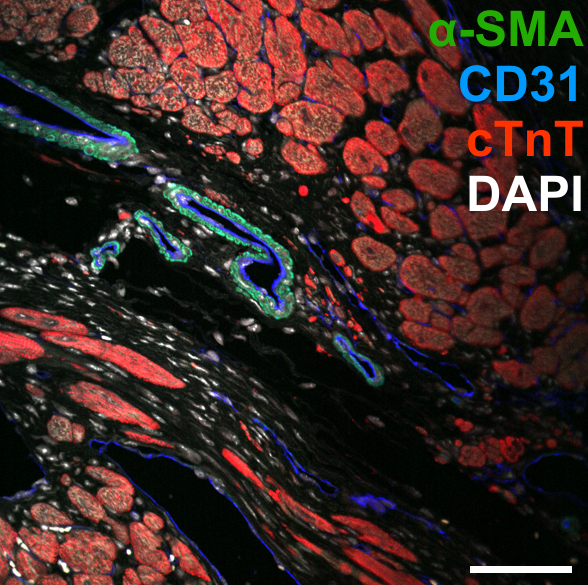 stained-hydrogels-for-heart-tissue-regeneration.png