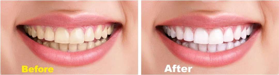 before and after.jpg