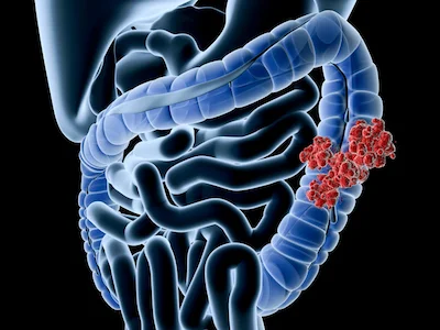 Colon.jpg