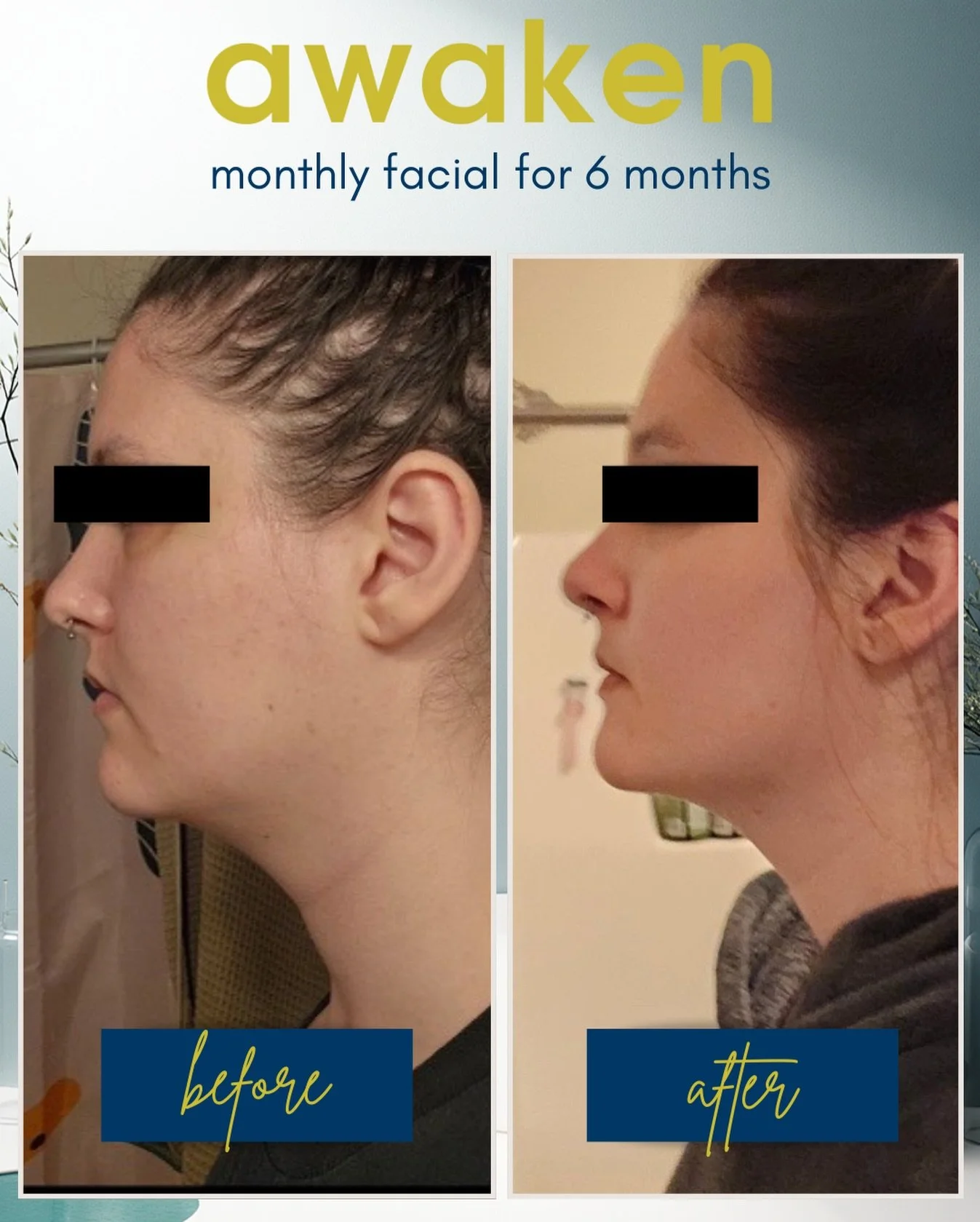 just look at what six monthly visits with Sidney can do!