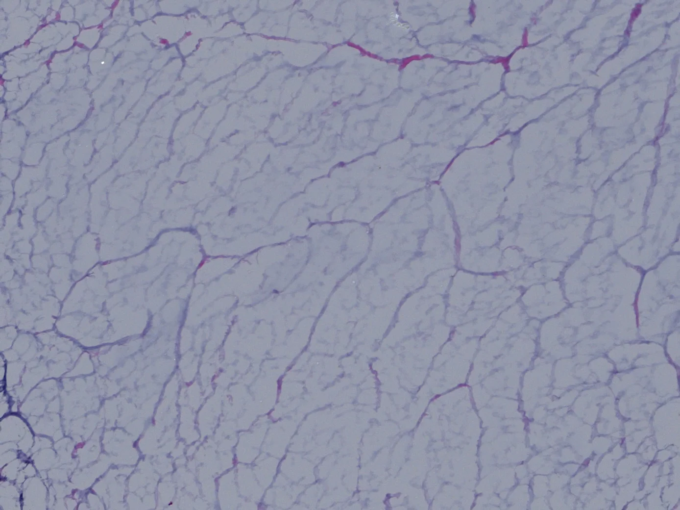 H0007_1.2_10x_decell.jpg