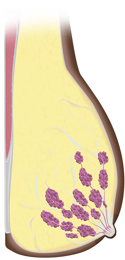 Illustrated_Breast_Schematics_SMALL.png