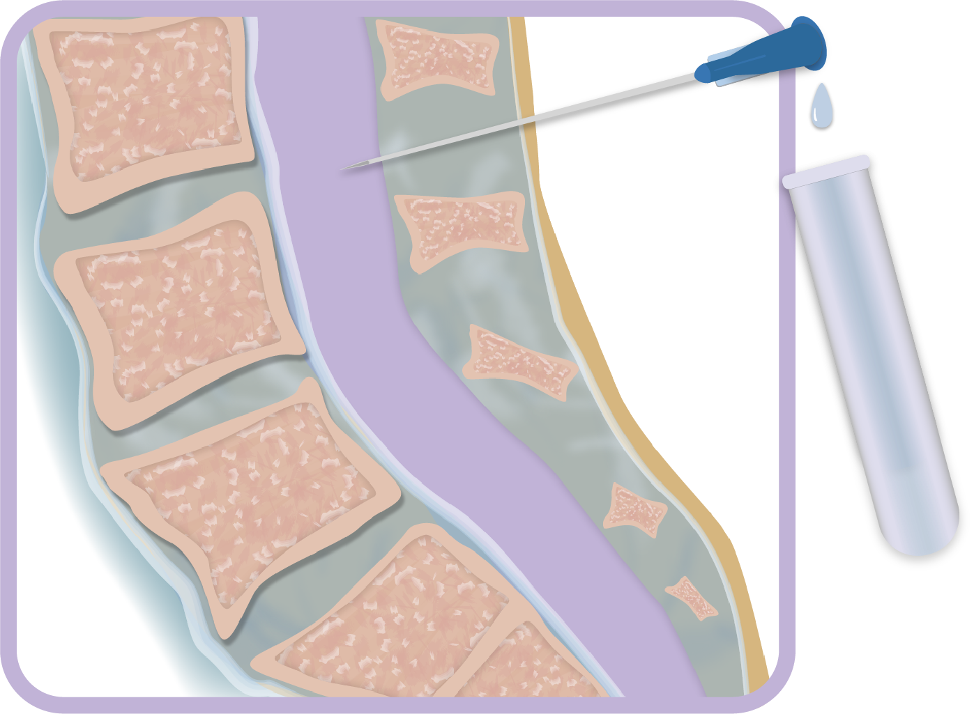back_anatomy_v5.png