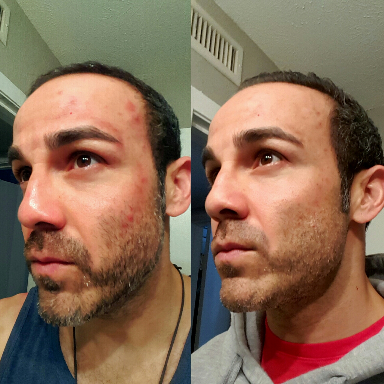 After a month on medication and also the day before starting the detox versus the day after finishing the detox. 