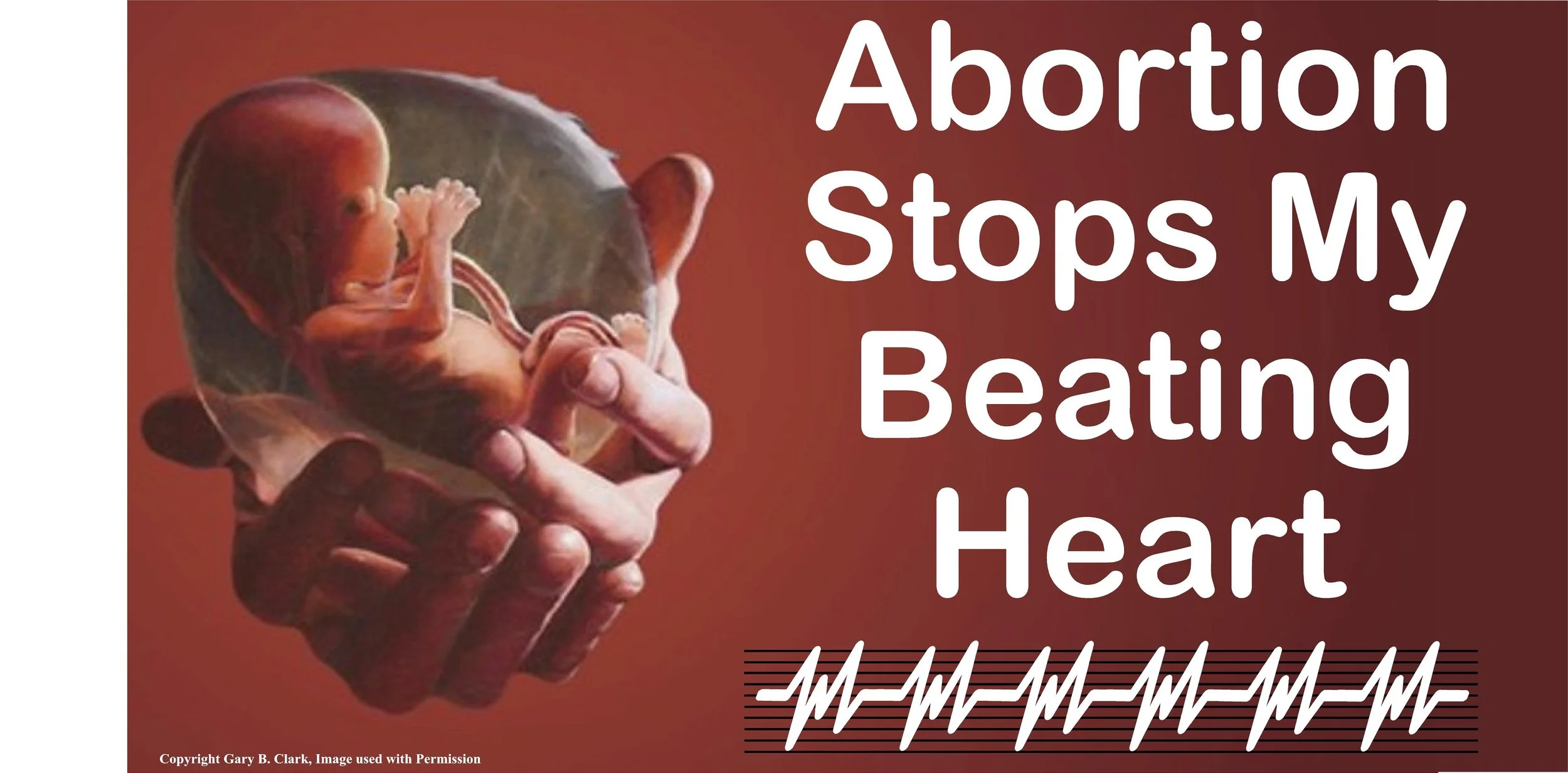 Abortion Stops my beating Heart