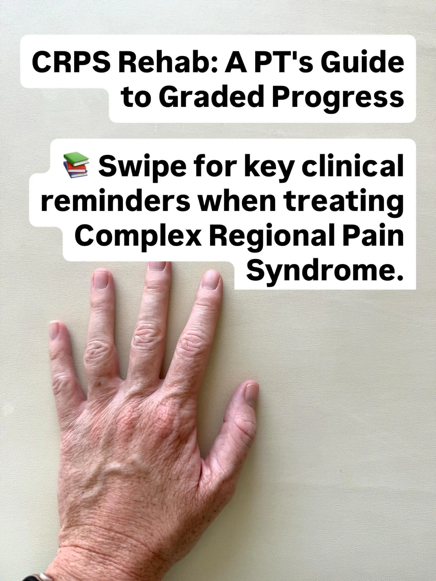 CRPS is notorious for being hard to treat. 
It’s estimated that 50% of those with upper extremity symptoms and 20% with lower extremity symptoms will have a complete resolution of symptoms.
One of the reasons it is so difficult is because CRP