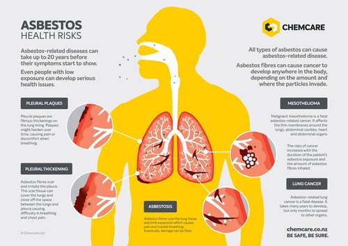 can asbestos cause throat cancer