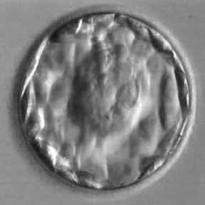 A five day old embryo, called a blastocyst