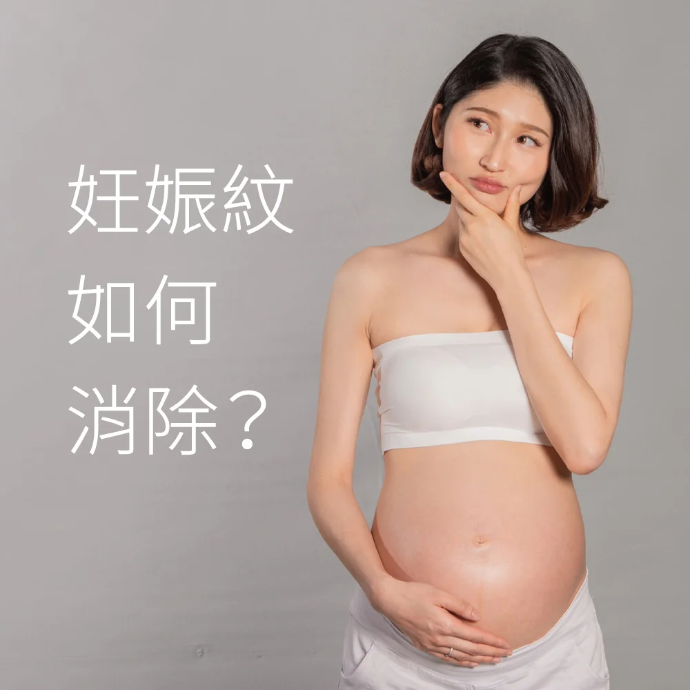 妊娠紋怎麼消除 加強肌膚修復速度 是關鍵 新肌霓ingeni 新肌霓ingeni