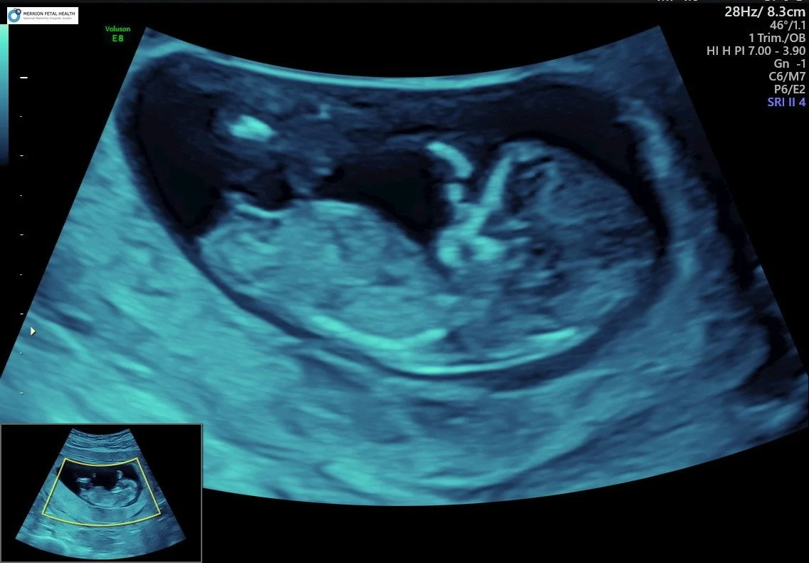 Part 6 | Lifestyle | Running with Child